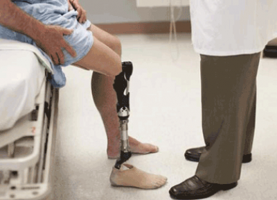 پیوند دست و پای قطع شده چگونه انجام می پذیرد؟
