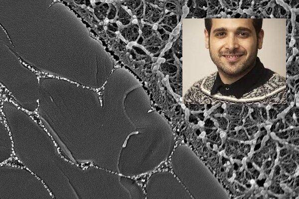 غضروف مصنوعی توسط محقق ایرانی ساخته شد غضروف مصنوعی توسط محقق ایرانی ساخته شد